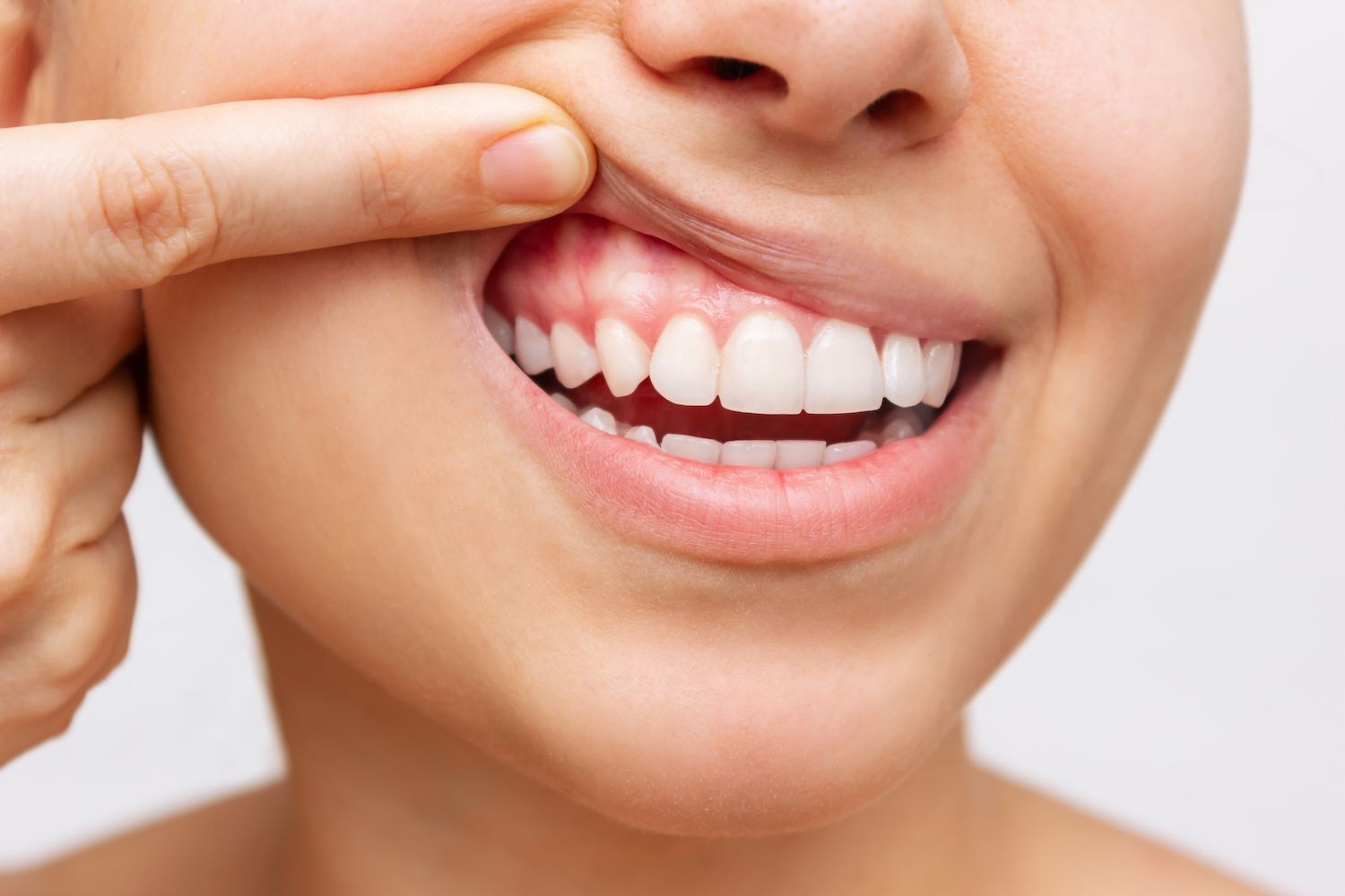 Maintaining Gum Health: A Comprehensive Guide to a Radiant Smile